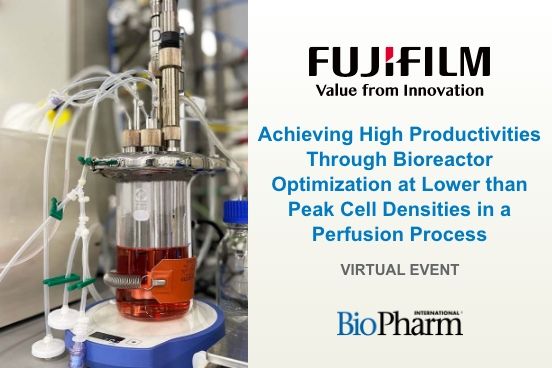 Achieving High Productivities through Bioreactor Optimization at Lower ...
