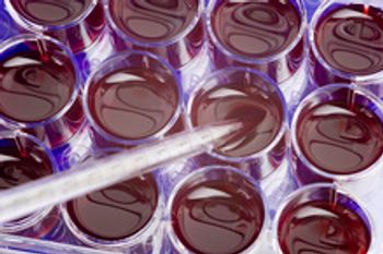 Biosimilar Filgrastim Performs in Stem Cell Mobilization