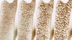 Romosozumab Biosimilar Matches Reference in Functional Testing Despite Disulfide Differences