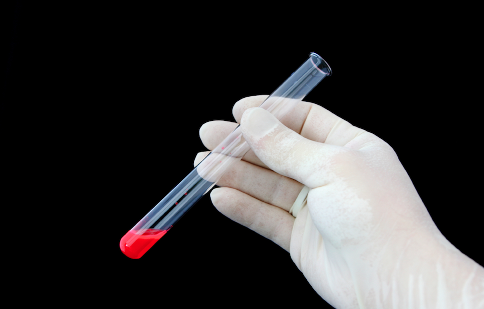 Risankizumab Outperforms Humira, Stelara in Treating Plaque Psoriasis