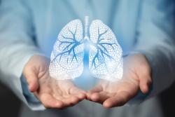 Retrospective Study Shows Bevacizumab Biosimilar Efficacy in NSCLC