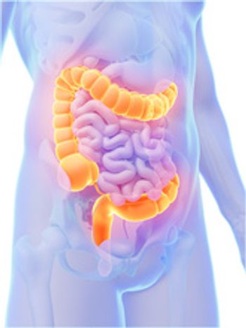 Researchers Present Findings on Switching to CT-P13 in IBD