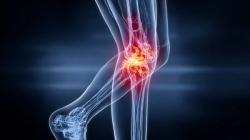 Denosumab Biosimilar LY01011 Shows Equivalence to Reference Product for Bone Metastases