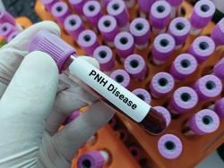 Biosimilar SB12 Matches Eculizumab in PNH Treatment Across Diverse Patient Groups