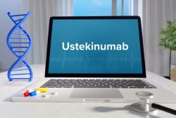 3 Ustekinumab Biosimilars Launch on US Market