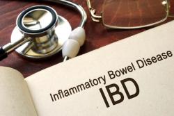 Patients With IBD Experience Nocebo Effect Post Mandatory Switch to Biosimilar