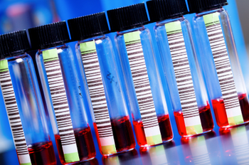 Patients Switched Between Biosimilar and Reference Filgrastim With No Clinically Meaningful Difference