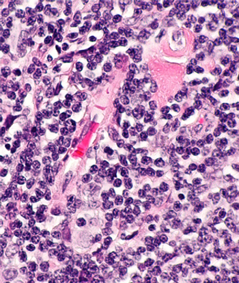 Data from the phase 1 ELM-1 trial and phase 2 ELM-2 trial support the marketing authorization application for odronextamab in relapsed/refractory follicular lymphoma and diffuse large B-cell lymphoma. 