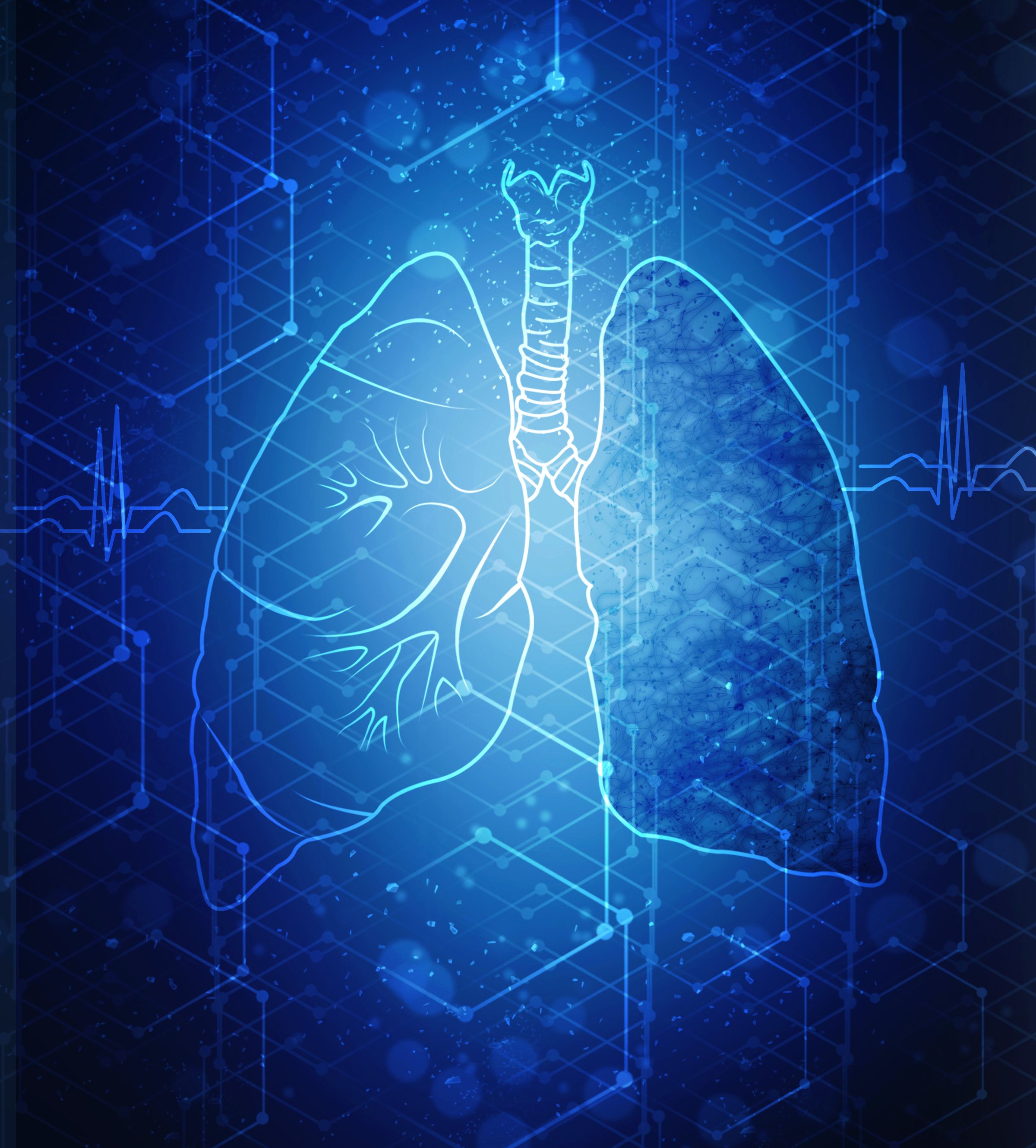 2021 Pipeline Updates: Upcoming Innovations in Non–Small Cell Lung Cancer