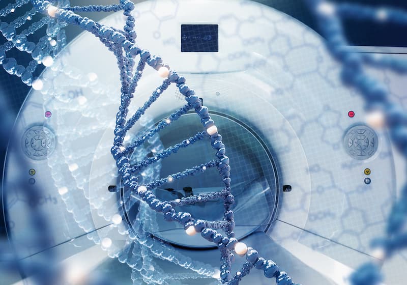 18F-Sodium Fluoride PET-CT Detects Bone Metastases More Accurately in 2 ...