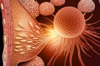Female breast cancer, Breast anatomy with cancer cells. 3d illustration: © Rasi - stock.adobe.com