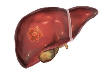 Survival benefits were observed across most post-hoc subgroups treated with anlotinib plus penpulimab, particularly among those with high-risk disease features.