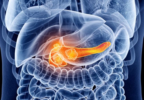 Philip Blumenfeld, MD, discussed the feasibility of Radium-224 Alpha DaRT sources delivered via endoscopic ultrasound for patients with pancreatic cancer.
