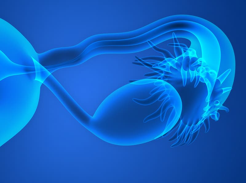 Treatment With Bevacizumab for 30 Months Provides No Benefit Over 15-Months in Ovarian Cancer