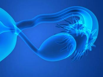 Treatment With Bevacizumab for 30 Months Provides No Benefit Over 15-Months in Ovarian Cancer