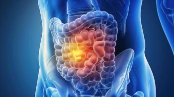 STELLAR-303 Regimen Misses End Point in CRC Population: © 姣姣 - stock.adobe.com