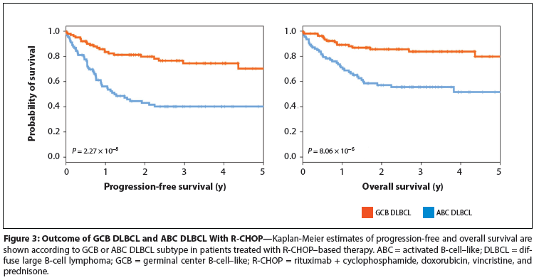 Appropriate Management Of Molecular Subtypes Of Diffuse Large B Cell Lymphoma
