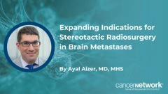 Ayal Aizer, MD, MHS, explains how expanded trial data have broadened eligibility for stereotactic radiosurgery in patients with brain metastases, including higher tumor counts.