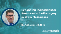 Ayal Aizer, MD, MHS, explains how expanded trial data have broadened eligibility for stereotactic radiosurgery in patients with brain metastases, including higher tumor counts.
