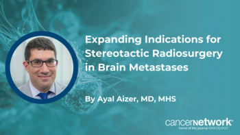 Ayal Aizer, MD, MHS, explains how expanded trial data have broadened eligibility for stereotactic radiosurgery in patients with brain metastases, including higher tumor counts.