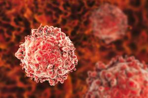 Targeting the Sanctuary Site: Options when Breast Cancer Metastasizes to the Brain