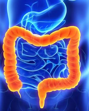 Consistent Activity of Trastuzumab Deruxtecan Reported for HER2+ mCRC