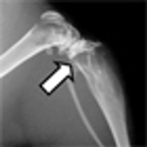 In Mouse Model, Imaging Strategy Follows Prostate Cancer Bone Metastasis Response to Cabozantinib