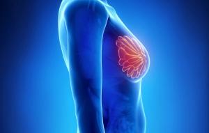 Updates in Surgical Management of the Axilla