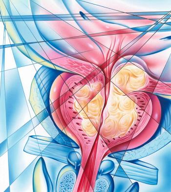 Data show improvements in overall survival and time to subsequent therapy initiation with darolutamide plus ADT/docetaxel.