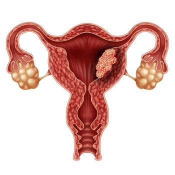 No deaths or significant adverse effects were reported in the screened population among those who received hysteroscopic resection for endometrial cancer.
