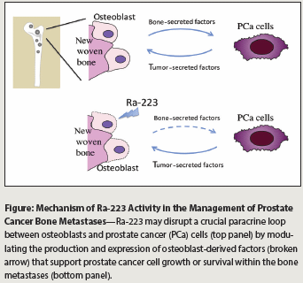 Radium 223 Optimizing Treatment And Research Of Osteoblastic Bone Metastasis