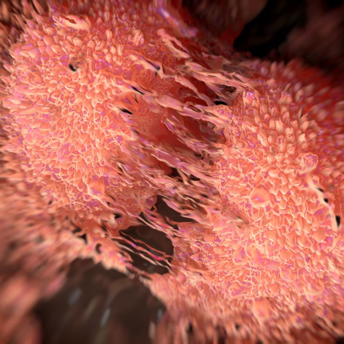 Data show no differences in bowel function between treatment arms based on factors including age, disease risk, and fractionation schedule.