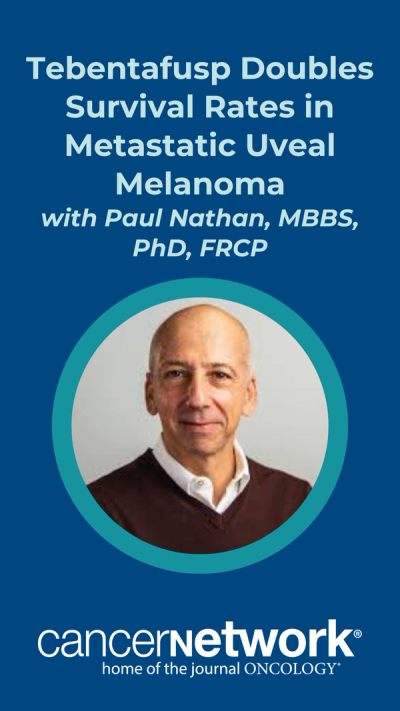 Tebentafusp Doubles Survival Rates in Metastatic Uveal Melanoma