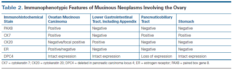 Morphologic Immunophenotypic And Molecular Features Of Epithelial Ovarian Cancer