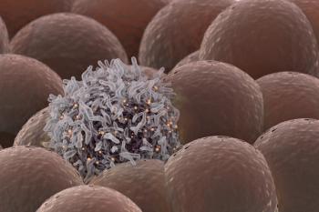 Findings from the phase 2 DART trial demonstrated that the combination of ipilimumab and nivolumab may have potential for the treatment of patients with angiosarcoma.