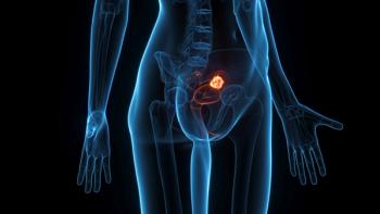 Relacorilant Combo Receives Positive CHMP Opinion in Ovarian Cancer: © Sebastian Kaulitzki - stock.adobe.com