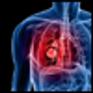 Lung Cancer Management in 2010