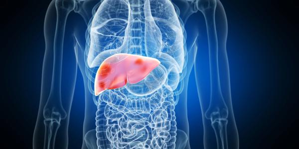 Proton Therapy Does Not Improve Survival in Hepatocellular Carcinoma: © Sebastian Kaulitzki - stock.adobe.com