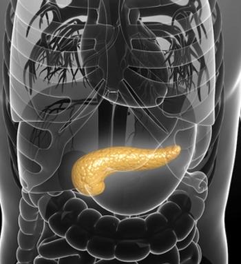 A combination of liposomal irinotecan plus 5-fluorouracil, leucovorin, and oxaliplatin in the frontline yields a statistically significant survival benefit compared with nab-paclitaxel and gemcitabine in a population diagnosed with metastatic pancreatic ductal adenocarcinoma.