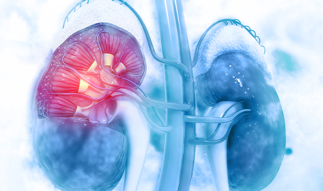 Safety data from the phase 2 LITESPARK-003 trial evaluating belzutifan/cabozantinib in renal cell carcinoma show no treatment-related deaths.