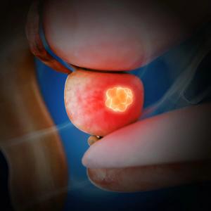 Findings from the phase 3 TALAPRO-2 trial showed that the safety profile of talazoparib was consistent with its known profile in metastatic CRPC.