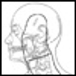 Radiotherapy for Cutaneous Malignant Melanoma: Rationale and Indications