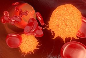 Manageable Anemia Achieved With Magrolimab Plus Azacitidine in High-Risk MDS/AML
