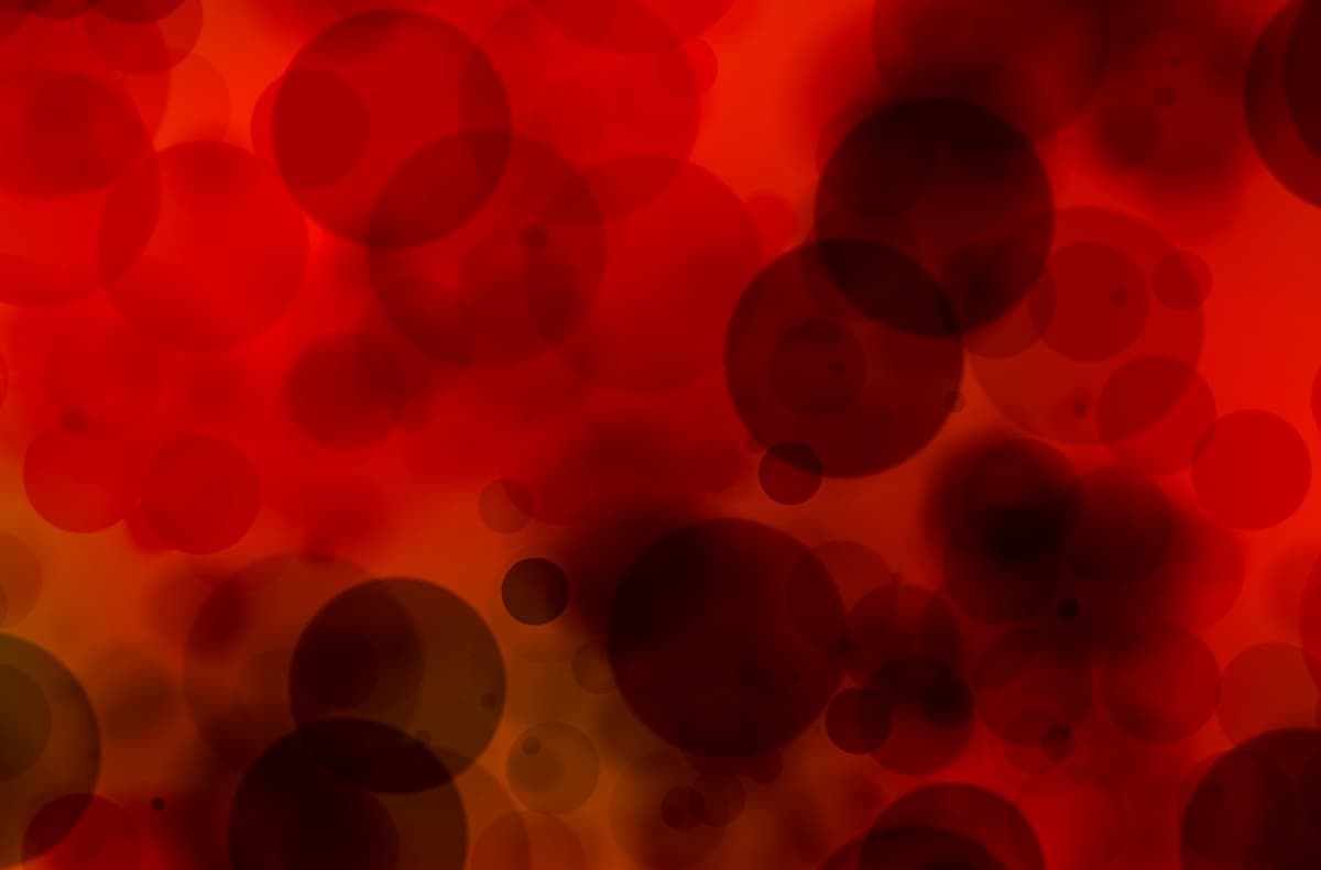 Dose reductions and interruptions of navitoclax plus ruxolitinib in the TRANSFORM-1 trial appear to be mostly due to thrombocytopenia, according to Naveen Pemmaraju, MD.