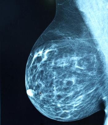 breast image