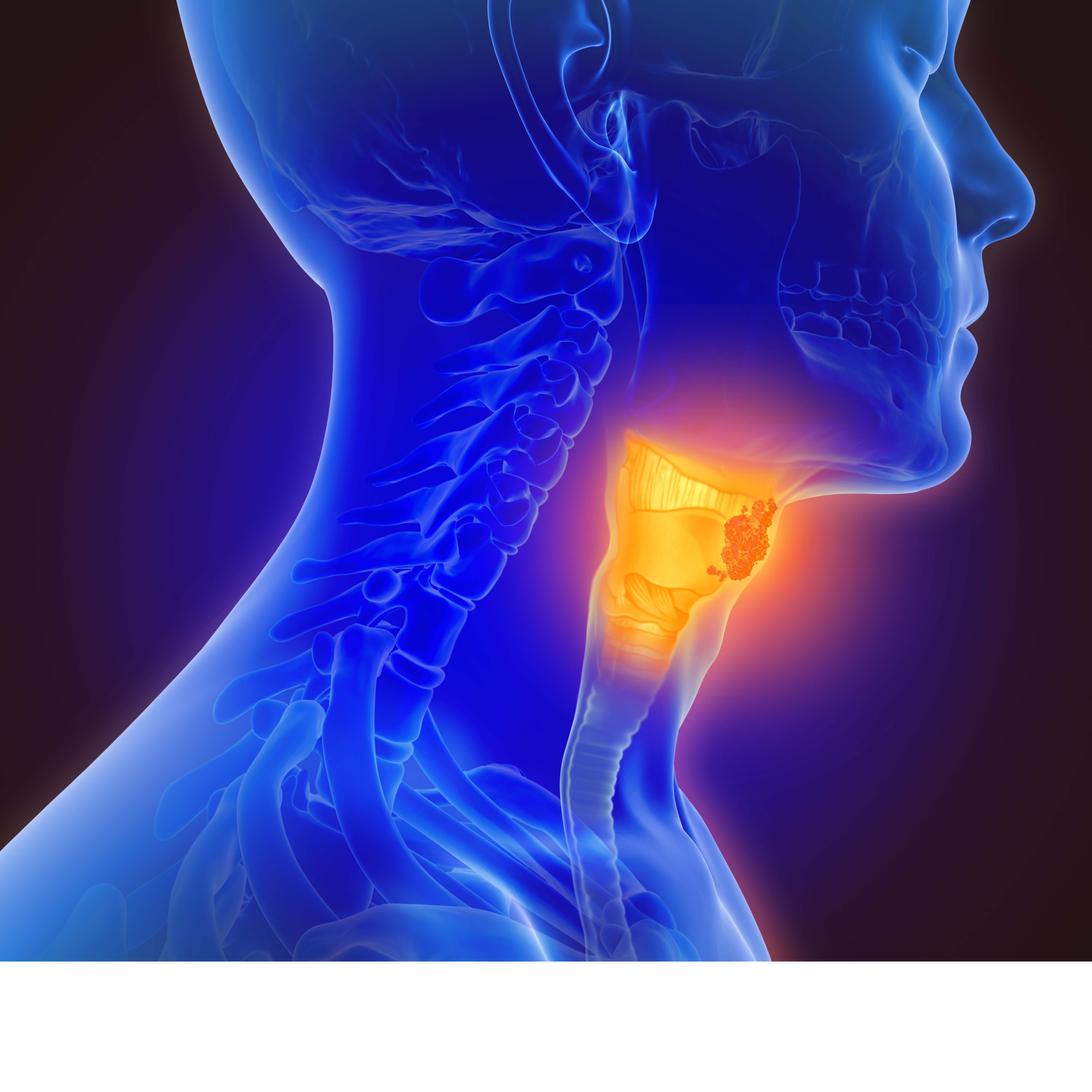 Although many clinical trials end due to strategic reasons, easing inclusion criteria and reducing potential operational failure may mitigate terminations.