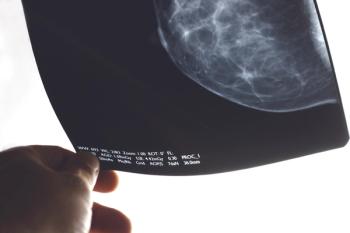 mammogram image