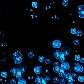 Data support incorporating volumetric PET biomarkers into toxicity risk prediction for patients receiving CAR T-cell therapy for LBCL.