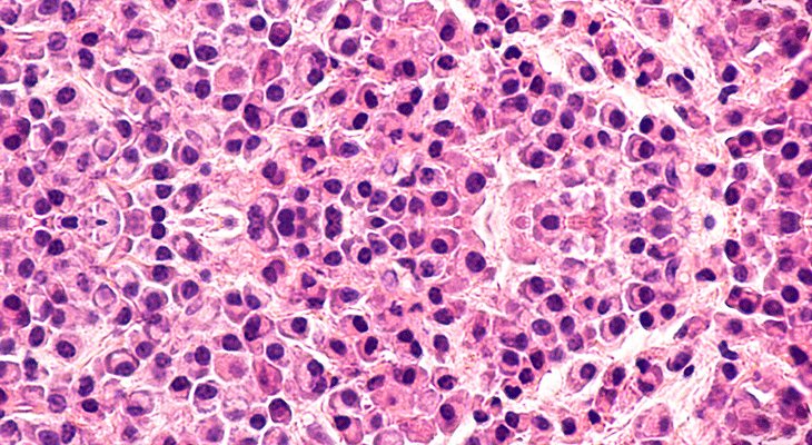 Hematology