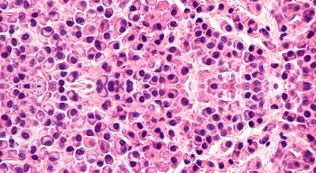 Hematology